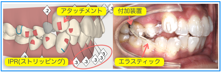 最新技術